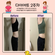 대전복부 다이어트 클리닉 ㅣ2주차 기록