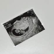 딱콩's 임신기록 #2. 임신9-10주 | 먹고 또 먹고, 복직 선물, 젤리곰 초음파, 방광염, 슬기로운 친정생활