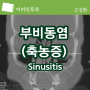 부비동염 sinusitis, 두통 치통 원인에 따른 증상, 진단, 치료