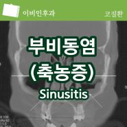 부비동염 sinusitis, 두통 치통 원인에 따른 증상, 진단, 치료