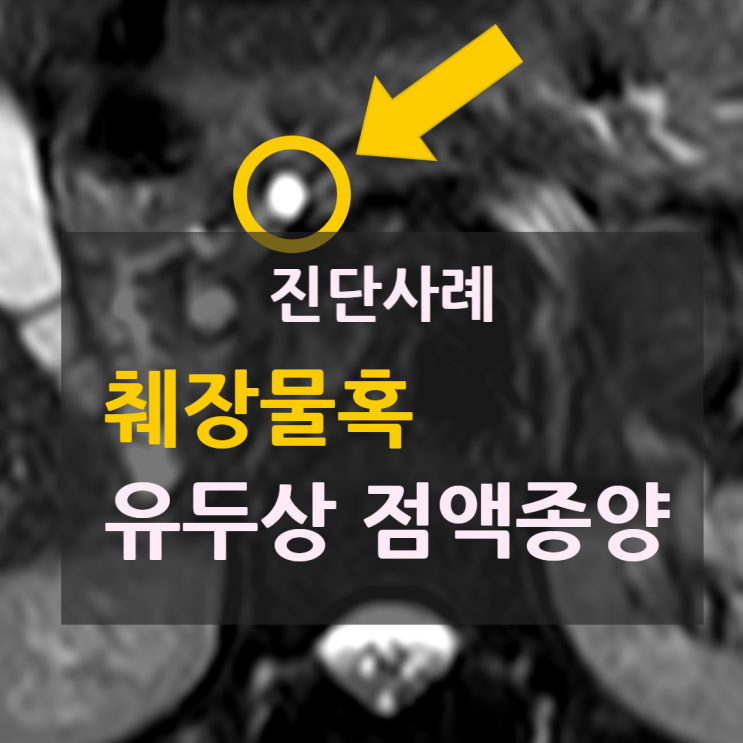 [진단사례] 건강검진 후 발견된 췌장물혹 > 췌관내 유두상 점액 종양 : 네이버 블로그