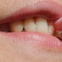 새해 치아 건강을 위한 팁! 칫솔은 최소 3개월에 1번씩 교체해야