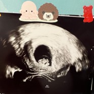임신 38주에 써보는 임신초기 기록