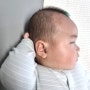신생아 지루성피부염, 아기 두피 각질 상처 후기