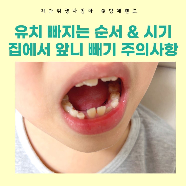 유치 빠지는 순서 영구치 나는 시기 이 나는 순서 치아개수 : 네이버 블로그