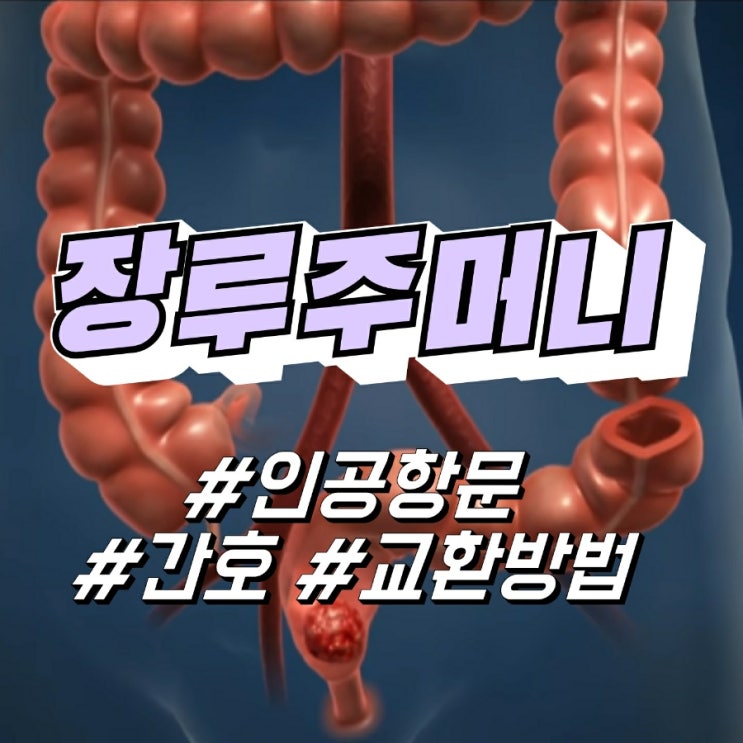 인공항문, 장루 주머니 (간호, 교환방법) : 네이버 블로그