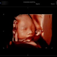 임신 7개월 25주 대구더블유여성병원 임당검사, 빈혈검사, 정밀초음파, 입체초음파