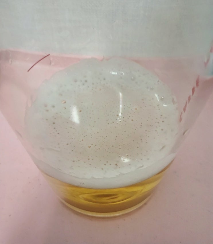 단백뇨/거품뇨 생기는 이유는 뭘까? 증상, 수치는 어떻게 될까? : 네이버 블로그