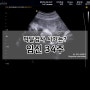 막달검사 시기는 임신34주 검사비용 포함
