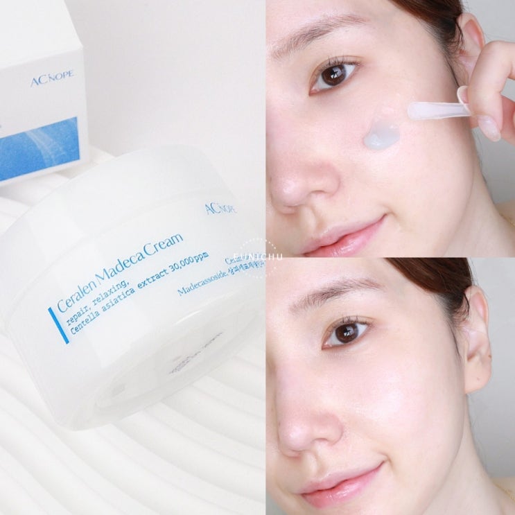 재생크림 추천 아크노프 세라솜 50000ppm 크림 : 네이버 블로그 재생크림 추천 아크노프 세라솜 50000Ppm 크림 : 네이버 블로그