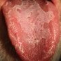 Tongue as a first-line immune organ? 면역계의 최전방에 있는 혀!