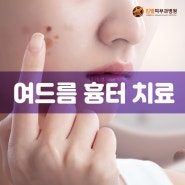 큐어젯 대전 여드름 흉터 치료 패인 자국