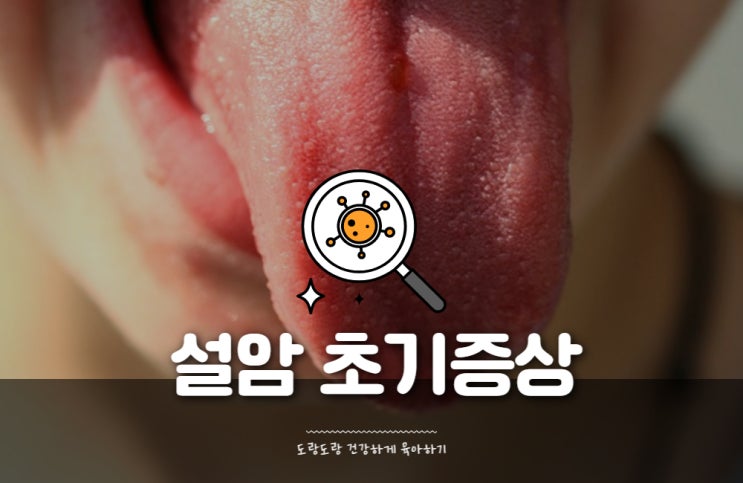 설암 초기증상 및 원인 치료 : 혀에 하얀 반점 염증 있다면 : 네이버 블로그