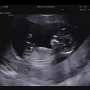 임신 기록 Part1. 아가와의 첫 만남(임신 초기~12주)