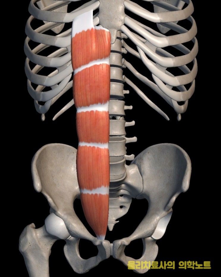 흉추 후만(Thoracic kyphosis)과 복직근(배곧은근, Rectus abdominis) 단축, 허리통증 관계 : 네이버 블로그