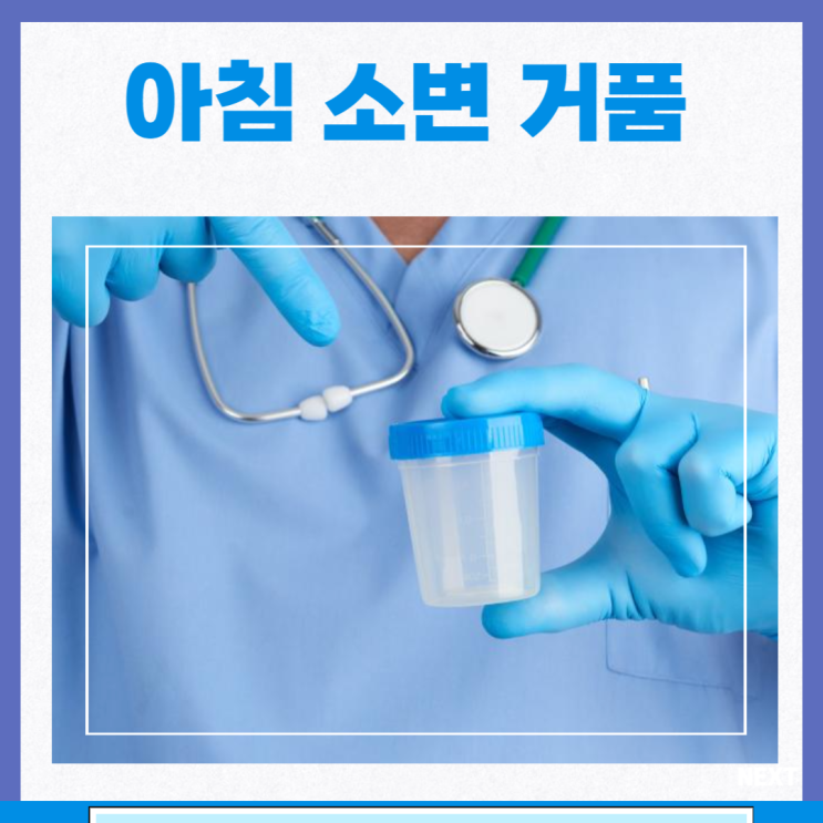 거품뇨 단백뇨 원인 검사 치료 예방 아침 소변 거품 : 네이버 블로그