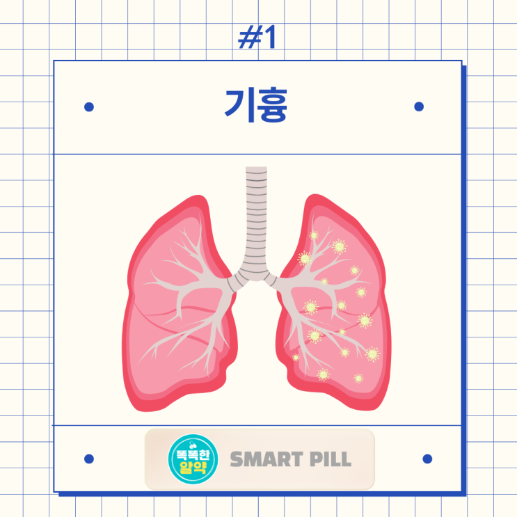 기흉 원인 증상 치료 예방, 기흉수술 꼭 해야하나? 재발 확률은? : 네이버 블로그