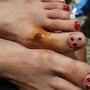 스펙타클한 방콕여행, 발가락 골절로 병원...