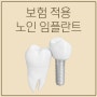 강남역 치과 노인 임플란트 건강보험 적용 비용
