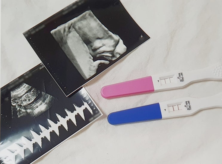 입덧 시작시기 끝나는 시기 입덧 심할때 완화방법 w 임신초기 입덧 증상 및 이유 : 네이버 블로그