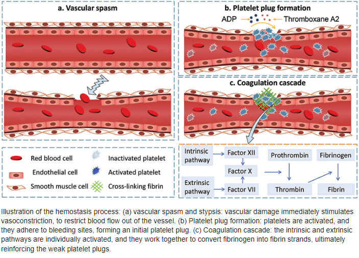 지혈 Hemostasis 과정, coagulation 응고 cascade : 네이버 블로그