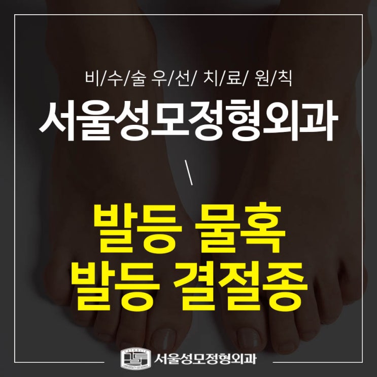 발등 혹(물혹) 원인 알아야 치료 : 네이버 블로그