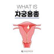 자궁용종이란? 원인, 증상, 치료방법, 자궁내막암