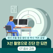 원인 모를 통증 원인 중 하나 ‘피로 골절’ X선 촬영으로 진단 안 되면 CT 검사 고려