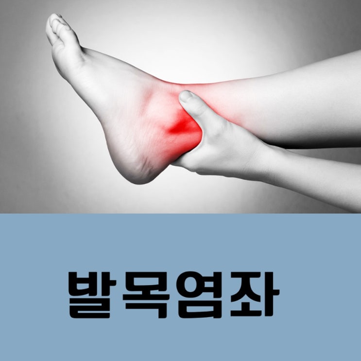 발목염좌 접질렀을때 발목부었을때 통증 치료 염좌치료 : 네이버 블로그
