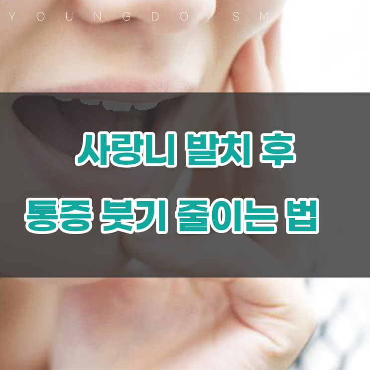 매복 사랑니발치 후 통증 붓기 줄이기 위해서 : 네이버 블로그 매복 사랑니발치 후 통증 붓기 줄이기 위해서 : 네이버 블로그