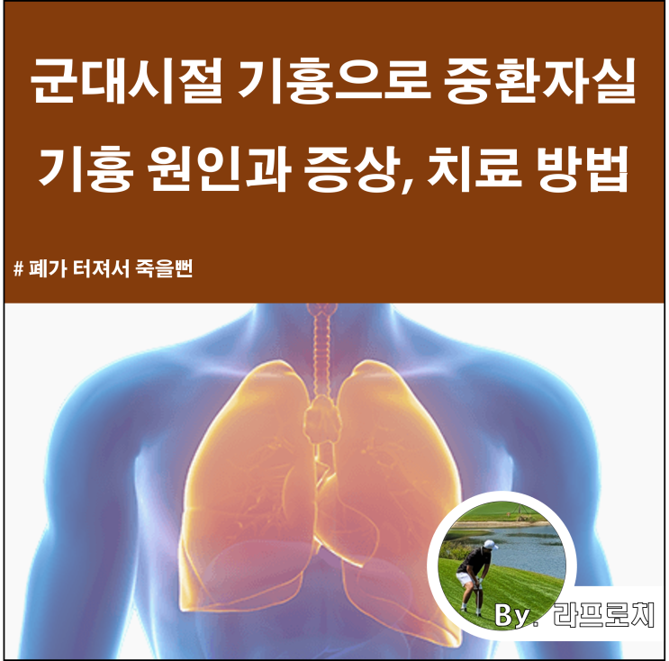 군대 시절 기흉으로 중환자실_기흉 원인과 증상, 시술 후기 : 네이버 블로그