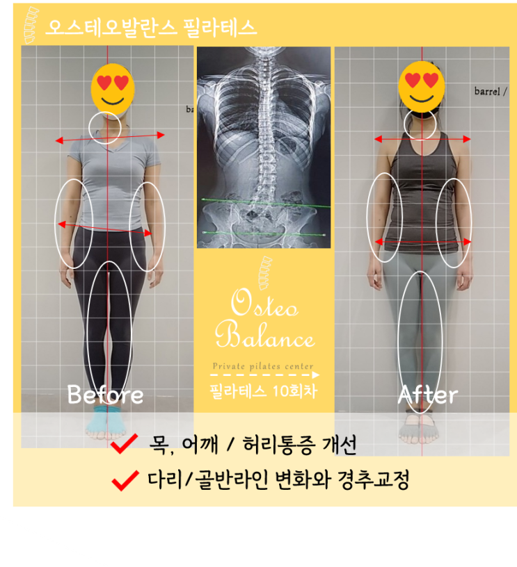 *오목교 필라테스: PT로 안 잡히던 허리·무릎 통증, 요추 측만 교정으로 완성한 다리 라인 (목동 신정동 오스테오발란스필라테스 ...