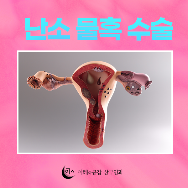 난소 물혹 수술 복강경, 비수술 경화술 어떤 차이가? : 네이버 블로그