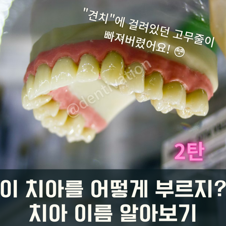 소구치? 견치? 치아이름 한글, 치아이름 영어로 알아보기 (치과용어 + 치과상식) : 네이버 블로그