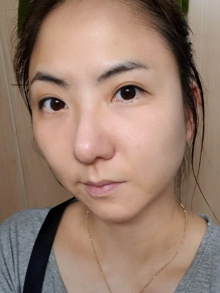 기미 주근깨 제거 천연팩으로 쌉가능 : 네이버 블로그