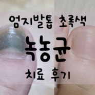 엄지 발톱이 초록색!? 녹농균치료 후기(혐오주의^^;)