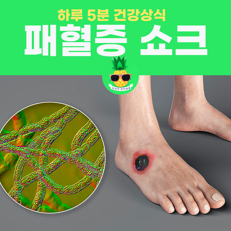 패혈증으로 쇼크까지? 패혈증 원인, 증상, 치료법 : 네이버 블로그