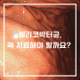 헬리코박터균, 꼭 치료해야 할까요?