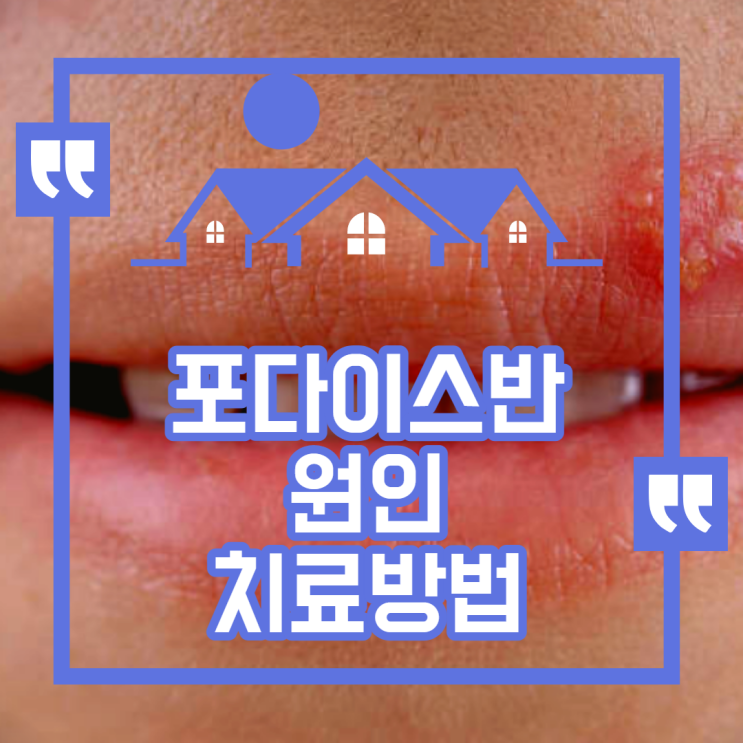 입술 포다이스반 하얀 점 원인 치료방법 알고 가세요 : 네이버 블로그