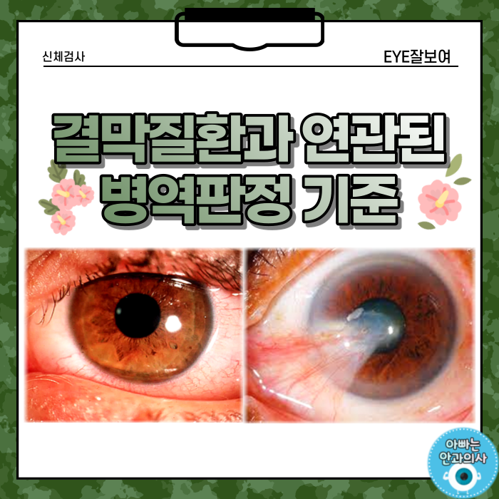 결막과 연관된 병역판정 기준 - 결막염, 안구건조증, 군날개(익상편) : 네이버 블로그