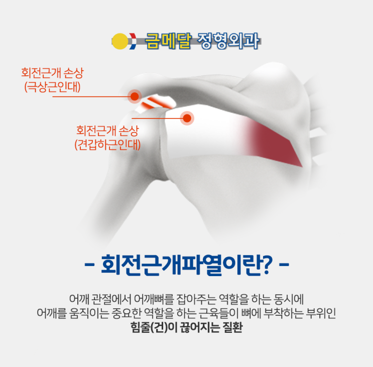 어깨회전근개건염 주의와 치료가 필요한 이유 : 네이버 블로그