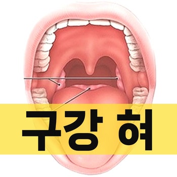구내염(입안염증), 설염(혀염증), 쇼그렌증후군(구강건조증)의 원인, 증상 및 치료 / 베체트병, 혀갈라짐, 혀통증, 구강작열감 ...