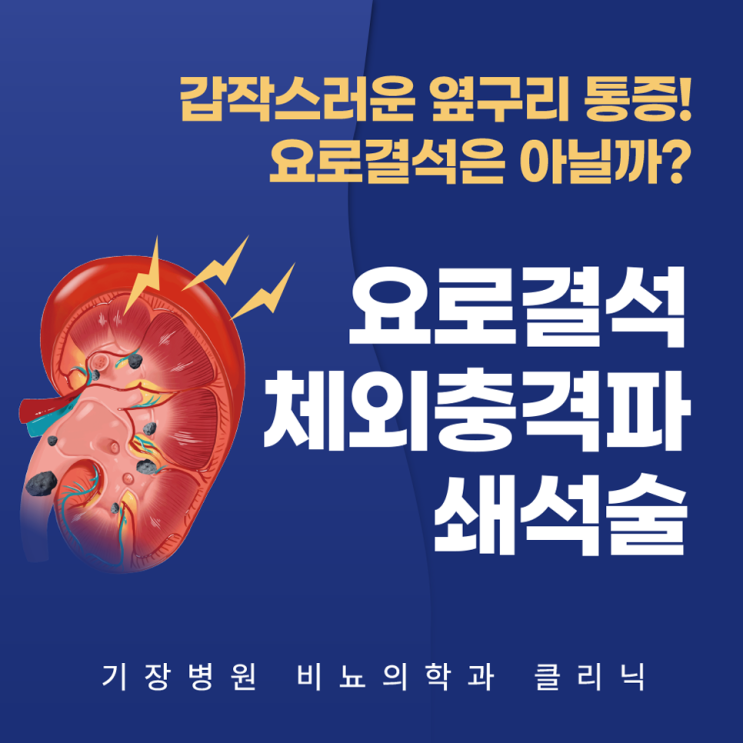 [비뇨의학과] 요로결석 체외충격파 쇄석술 클리닉 : 네이버 블로그