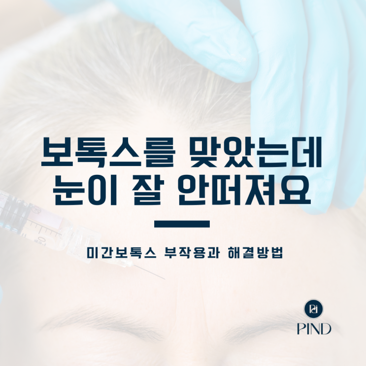 [보톡스] 미간 보톡스 효과, 부작용과 치료과정 : 네이버 블로그