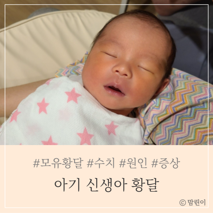 아기 신생아 황달 모유황달 증상 수치 원인 : 네이버 블로그