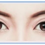 쌍꺼풀 첫수술 & 재수술 전문 두드림 성형외과 <유형별 눈 성형 재수술 방법>