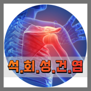 석회성건염 어깨 치료 증상 운동 통증 수술 원인