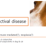 Conjunctival disease(결막 질환)