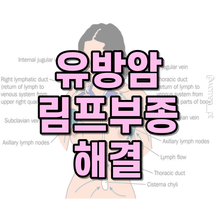 유방암 림프부종의 단계와 치료법[부종관리/림프부종/림프마사지/도수림프배출법] : 네이버 블로그