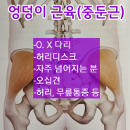 엉덩이 뭉침, OX다리, 허리디스크, 오십견, 허리,무릎통증이 있을 때_엉덩이근육(중둔근)을 살펴볼까요🤓🤓